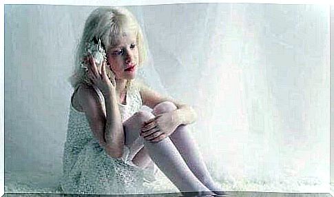 Little girl with albinism.