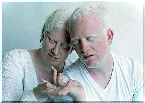 Couples living with albinism.